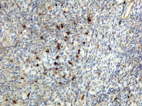 Immunohistochemistry (Formalin/PFA-fixed paraffin-embedded sections) - Anti-Human IgA antibody [RM128] (AB193189)