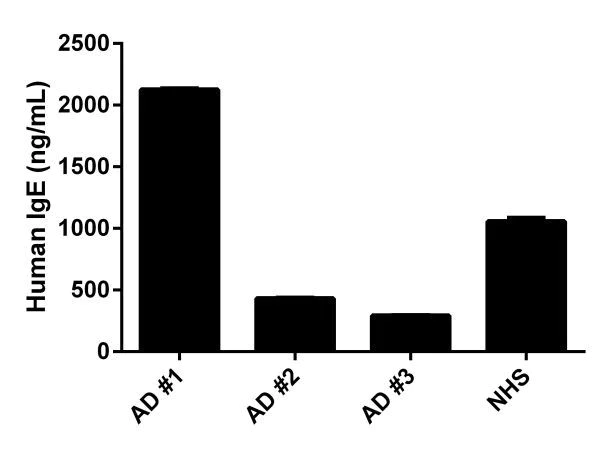 Sandwich ELISA - Human IgE ELISA Kit (AB195216)