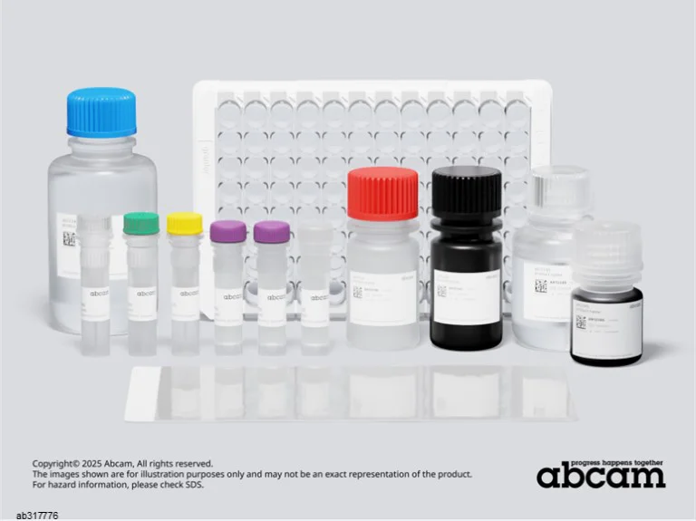 Sandwich ELISA - Human IgE ELISA Kit (AB317776)