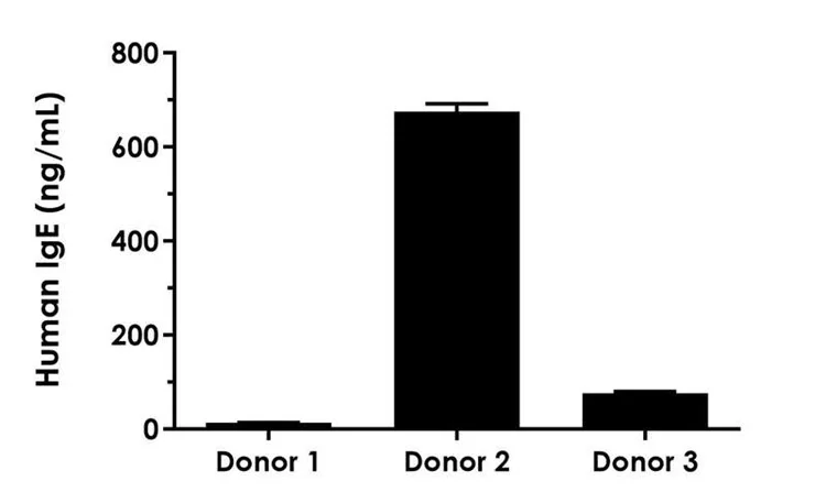 Sandwich ELISA - Human IgE ELISA Kit, Chemiluminescent (AB325727)