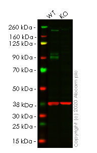 Western blot - Human IGF1R (IGF1 Receptor) knockout HeLa cell lysate (AB256951), expandable thumbnail