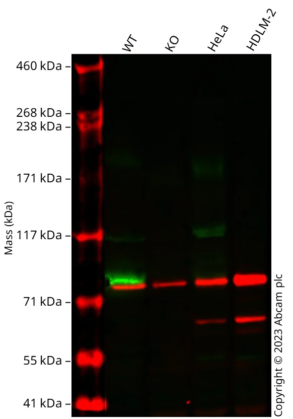 Western blot - Human IGF1R knockout MCF7 cell line (AB287507)