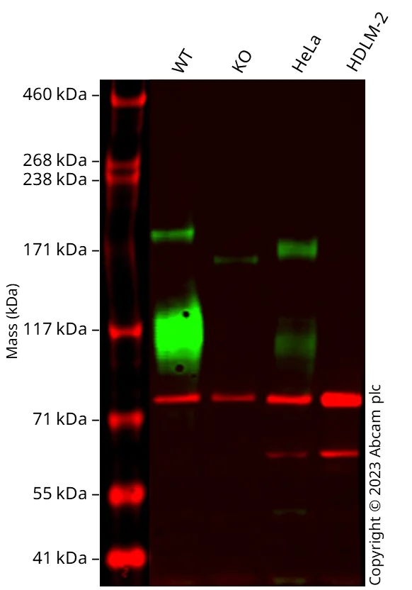 Western blot - Human IGF1R knockout MCF7 cell line (AB287507)