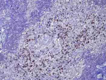 Immunohistochemistry (Formalin/PFA-fixed paraffin-embedded sections) - Anti-Human IgG antibody [E20V] (AB180555)