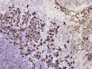 Immunohistochemistry (Formalin/PFA-fixed paraffin-embedded sections) - Anti-Human IgG antibody [E20V] (AB180555)