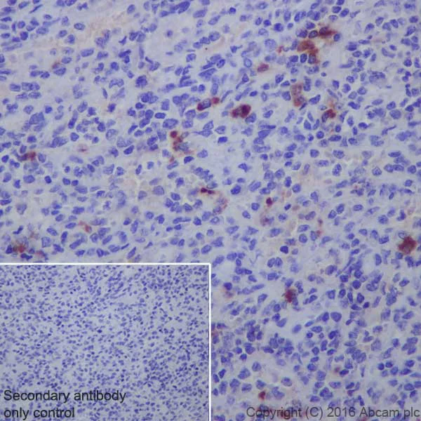Immunohistochemistry (Formalin/PFA-fixed paraffin-embedded sections) - Anti-Human IgG antibody [EPR12700] - BSA and Azide free (AB250451)
