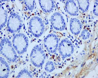 Immunohistochemistry (Formalin/PFA-fixed paraffin-embedded sections) - Anti-Human IgG antibody [EPR12700] - BSA and Azide free (AB250451)