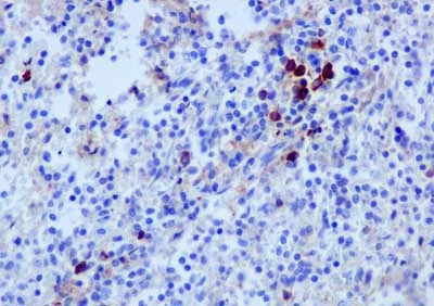 Immunohistochemistry (Formalin/PFA-fixed paraffin-embedded sections) - Anti-Human IgG antibody [EPR12700] - BSA and Azide free (AB250451)