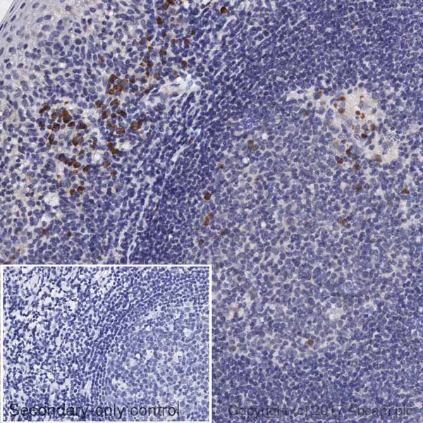 Immunohistochemistry (Formalin/PFA-fixed paraffin-embedded sections) - Anti-Human IgG antibody [EPR21250] (AB213242)