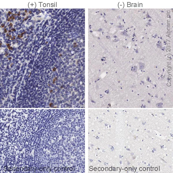 Immunohistochemistry (Formalin/PFA-fixed paraffin-embedded sections) - Anti-Human IgG antibody [EPR21250] (AB213242)