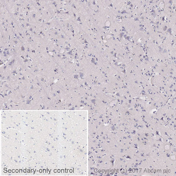 Immunohistochemistry (Formalin/PFA-fixed paraffin-embedded sections) - Anti-Human IgG antibody [EPR21250] (AB213242)