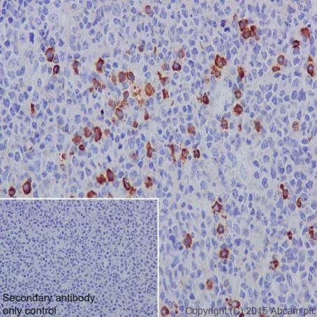 Immunohistochemistry (Formalin/PFA-fixed paraffin-embedded sections) - Anti-Human IgG antibody [EPR4421] (AB109489)