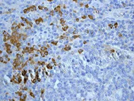 Immunohistochemistry (Formalin/PFA-fixed paraffin-embedded sections) - Anti-Human IgG antibody [EPR4421] (AB109489)
