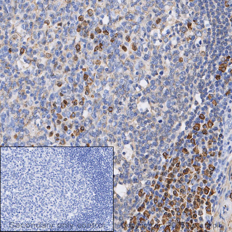 Immunohistochemistry (Formalin/PFA-fixed paraffin-embedded sections) - Anti-Human IgG antibody [EPR4421] (AB109489)