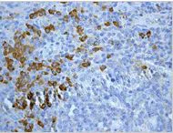 Immunohistochemistry (Formalin/PFA-fixed paraffin-embedded sections) - Anti-Human IgG antibody [EPR4421] - BSA and Azide free (AB226069)