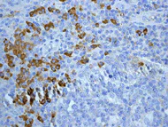 Immunohistochemistry (Formalin/PFA-fixed paraffin-embedded sections) - Anti-Human IgG antibody [EPR4421] - Low endotoxin, Azide free (AB216446)