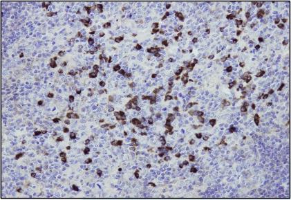 Immunohistochemistry (Formalin/PFA-fixed paraffin-embedded sections) - Anti-Human IgG antibody [I17-T] (AB180635), expandable thumbnail