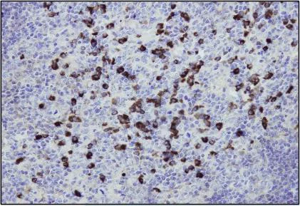Immunohistochemistry (Formalin/PFA-fixed paraffin-embedded sections) - Anti-Human IgG antibody [I17-T] (AB180635)