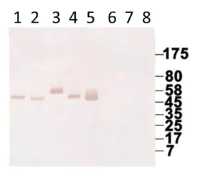 Western blot - Anti-Human IgG antibody [KT131] (AB211339)