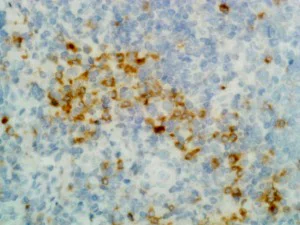 Immunohistochemistry (Formalin/PFA-fixed paraffin-embedded sections) - Anti-Human IgG antibody [RM116] (AB195574)