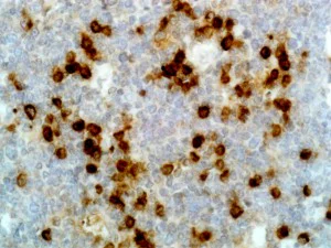Immunohistochemistry (Formalin/PFA-fixed paraffin-embedded sections) - Anti-Human IgG Lambda Light Chain antibody [RM127] (AB195573)