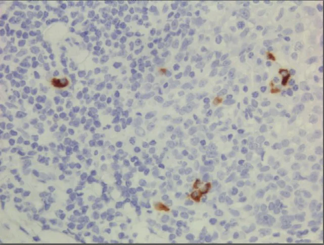 Immunohistochemistry (Formalin/PFA-fixed paraffin-embedded sections) - Anti-Human IgG3 antibody [RM119] (AB193172)