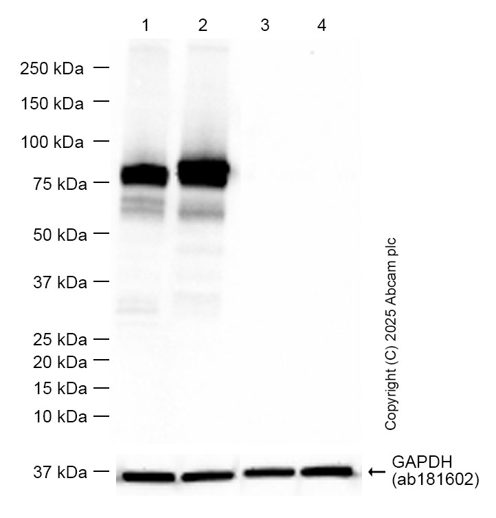 Western blot - Anti-Human IgM antibody [EPR20731] (AB212201)