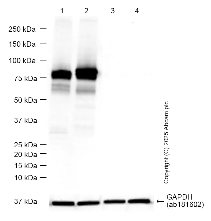 Western blot - Anti-Human IgM antibody [EPR20731] (AB212201)
