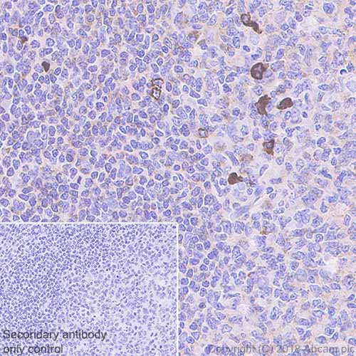 Immunohistochemistry (Formalin/PFA-fixed paraffin-embedded sections) - Anti-Human IgM antibody [EPR5539-65-4] (AB134159), expandable thumbnail