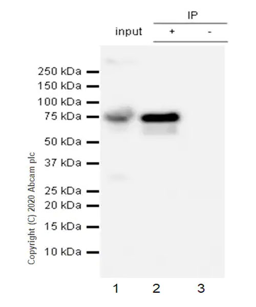 Immunoprecipitation - Anti-Human IgM antibody [EPR5539-65-4] (AB134159), expandable thumbnail