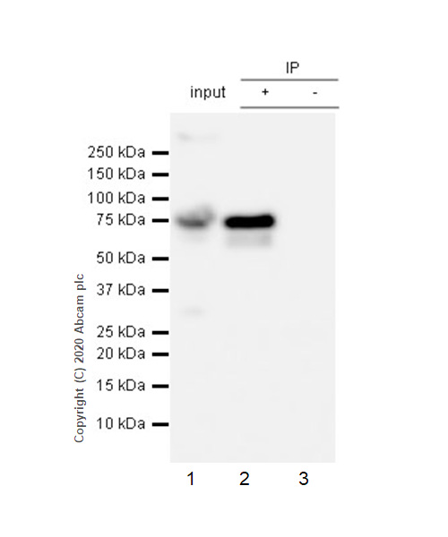 Immunoprecipitation - Anti-Human IgM antibody [EPR5539-65-4] (AB134159), expandable thumbnail