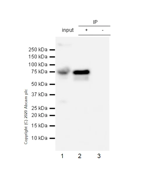 Immunoprecipitation - Anti-Human IgM antibody [EPR5539-65-4] (AB134159)