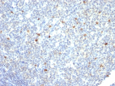 Immunohistochemistry (Formalin/PFA-fixed paraffin-embedded sections) - Anti-Human IgM antibody [IM260] - BSA and Azide free (AB233886), expandable thumbnail
