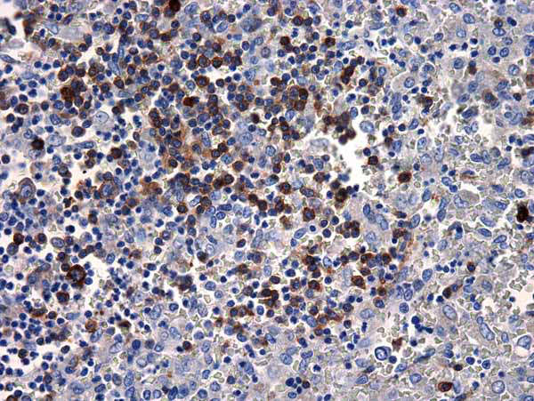 Immunohistochemistry (Formalin/PFA-fixed paraffin-embedded sections) - Anti-Human IgM antibody [R1/69] (AB17104)