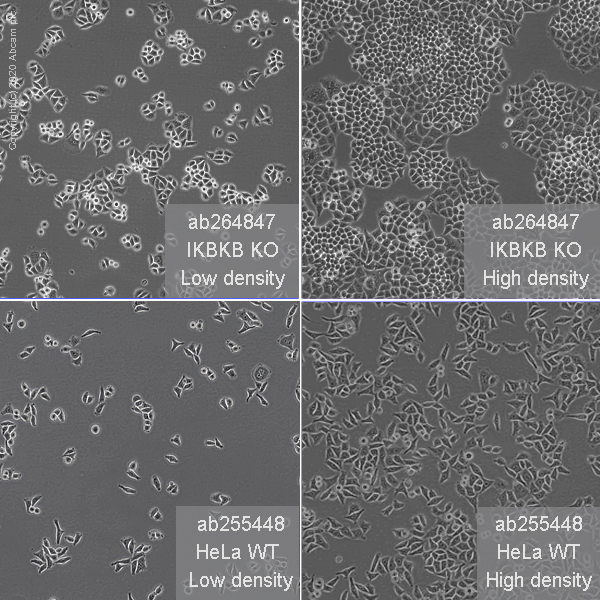 Human IKBKB (IKK beta) knockout HeLa cell line