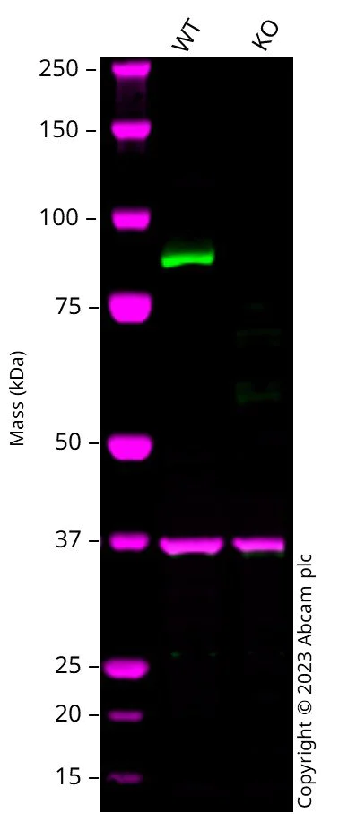 Western blot - Human IKBKB (IKK beta) knockout HeLa cell line (AB264847)