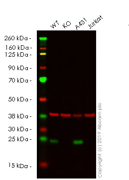 Western blot - Human IL18 knockout HeLa cell lysate (AB256952), expandable thumbnail