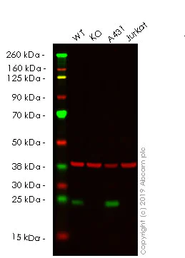 Western blot - Human IL18 knockout HeLa cell lysate (AB256952)