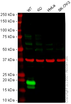 Western blot - Human IL1RN (IL1 Receptor Antagonist) knockout A-431 cell line (AB273379)