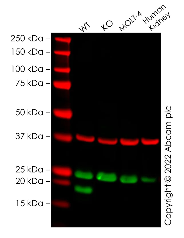 Western blot - Human IL1RN (IL1 Receptor Antagonist) knockout A-431 cell lysate (AB275530)