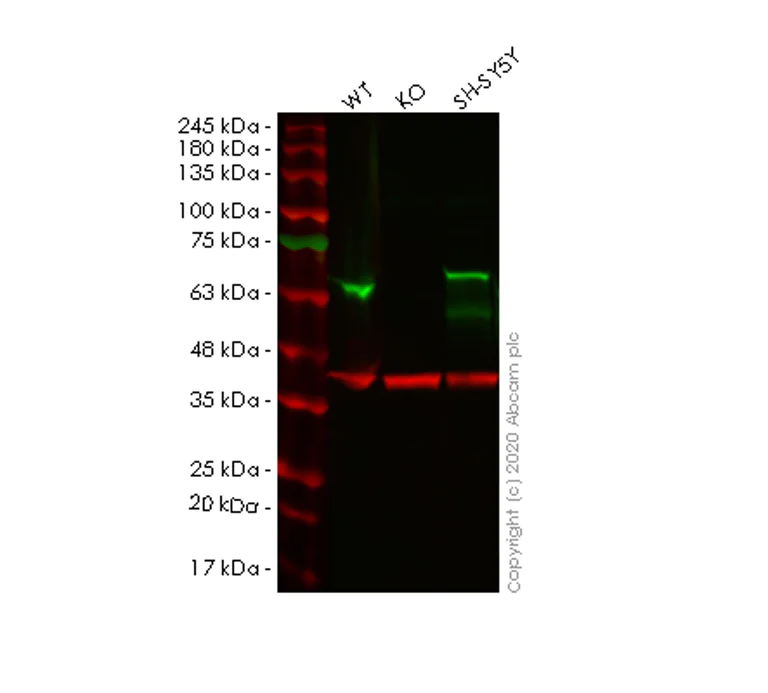 Western blot - Human INA (alpha Internexin) knockout HeLa cell lysate (AB257482)