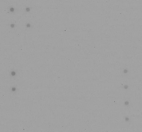 Multiplex Protein Detection - Human Inflammation Antibody Array - Membrane (20 targets) (AB169804)