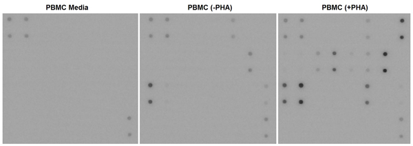 Multiplex Protein Detection - Human Inflammation Antibody Array - Membrane (20 targets) (AB169804), expandable thumbnail