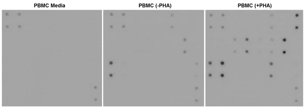 Multiplex Protein Detection - Human Inflammation Antibody Array - Membrane (20 targets) (AB169804)