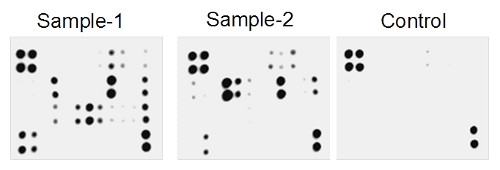 Multiplex Protein Detection - Human Inflammation Antibody Array - Membrane (20 targets) (AB169804), expandable thumbnail