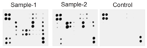 Multiplex Protein Detection - Human Inflammation Antibody Array - Membrane (20 targets) (AB169805), expandable thumbnail
