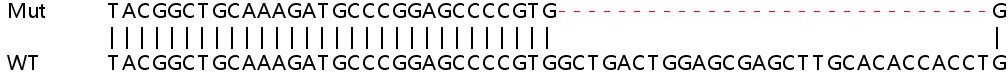 Sanger Sequencing - Human IPPK (IPK1) knockout HEK-293T cell lysate (AB258925)