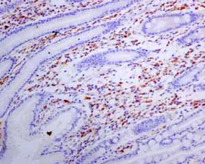 Immunohistochemistry (Formalin/PFA-fixed paraffin-embedded sections) - Anti-Human Kappa Chain antibody [EPR5539-71-8] (AB134929)