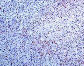 Immunohistochemistry (Formalin/PFA-fixed paraffin-embedded sections) - Anti-Human Kappa Chain antibody [EPR5539-71-8] - BSA and Azide free (AB211641)