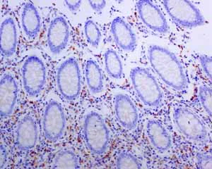 Immunohistochemistry (Formalin/PFA-fixed paraffin-embedded sections) - Anti-Human Kappa Chain antibody [EPR5539-71-8] - BSA and Azide free (AB211641)